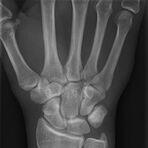 Röntgenaufnahme einer Hand